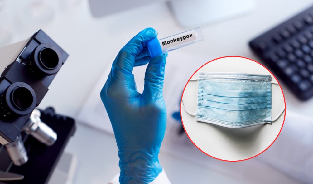 La OMS solicita al personal de la salud el uso de taoabocas, en caso de estar cerca de pacientes con mpox. ( Foto: Getty / Caracol Radio )