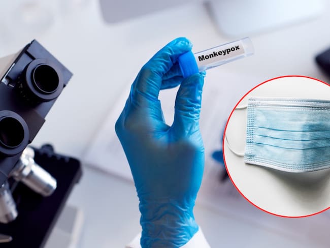 La OMS solicita al personal de la salud el uso de taoabocas, en caso de estar cerca de pacientes con mpox. ( Foto: Getty / Caracol Radio )