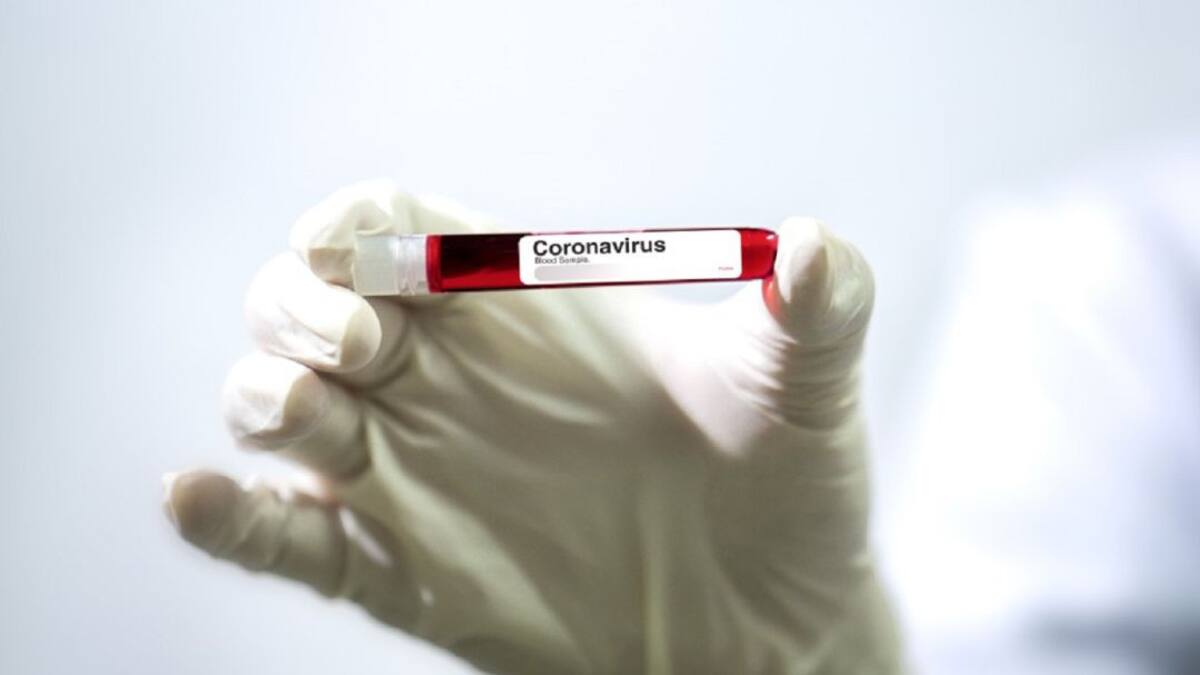 Se confirman tres casos más de Coronavirus en Medellín
