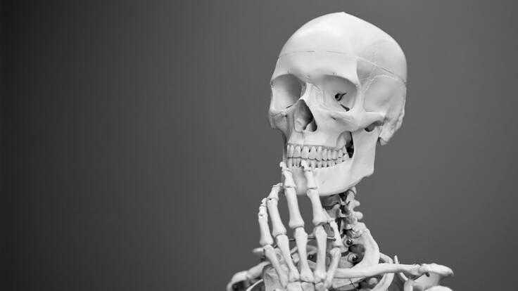 ¿Qué es la osteoporosis?