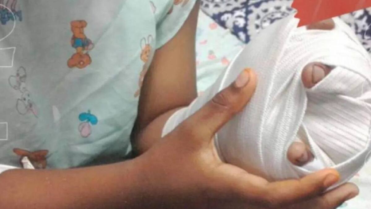 Con 91 casos de lesionados con pólvora cerraron las fiestas de fin de año