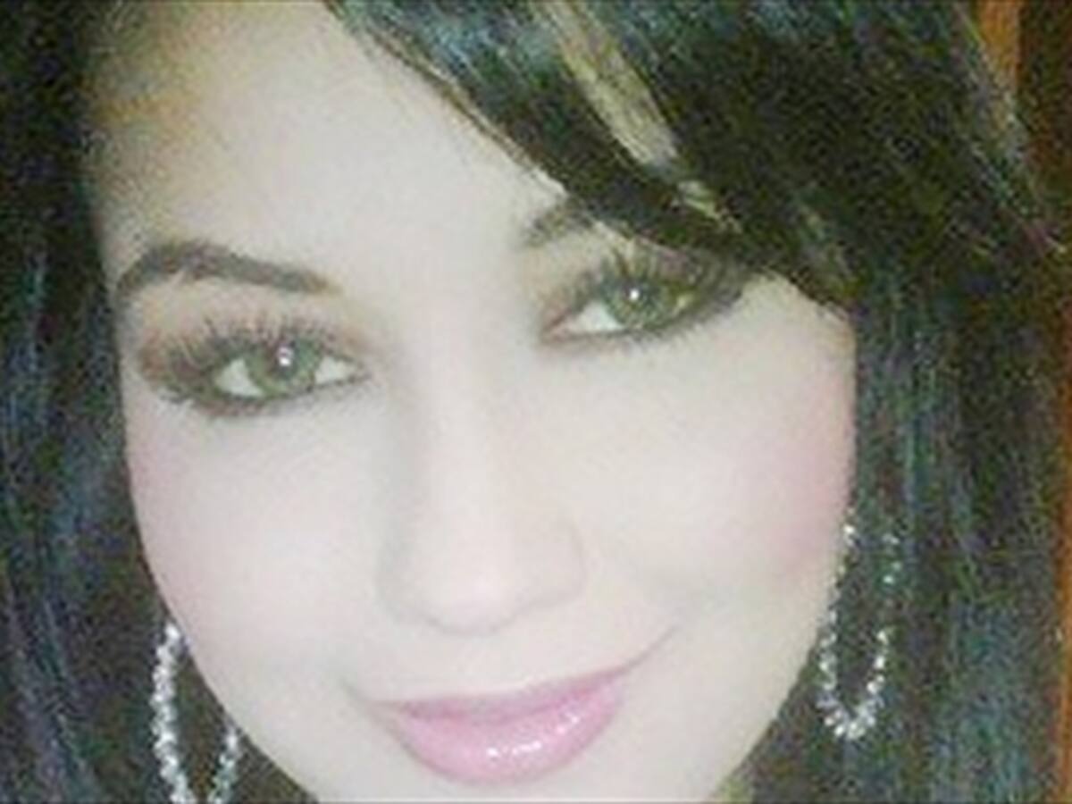 En Armenia muere una mujer después de practicarse una cirugía plástica