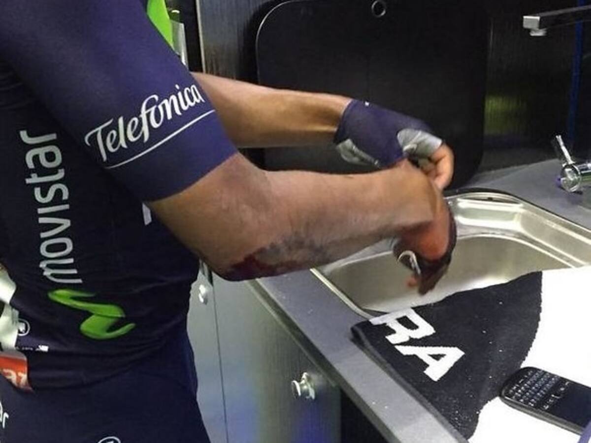 El empeño de Nairo supera las heridas del Tour