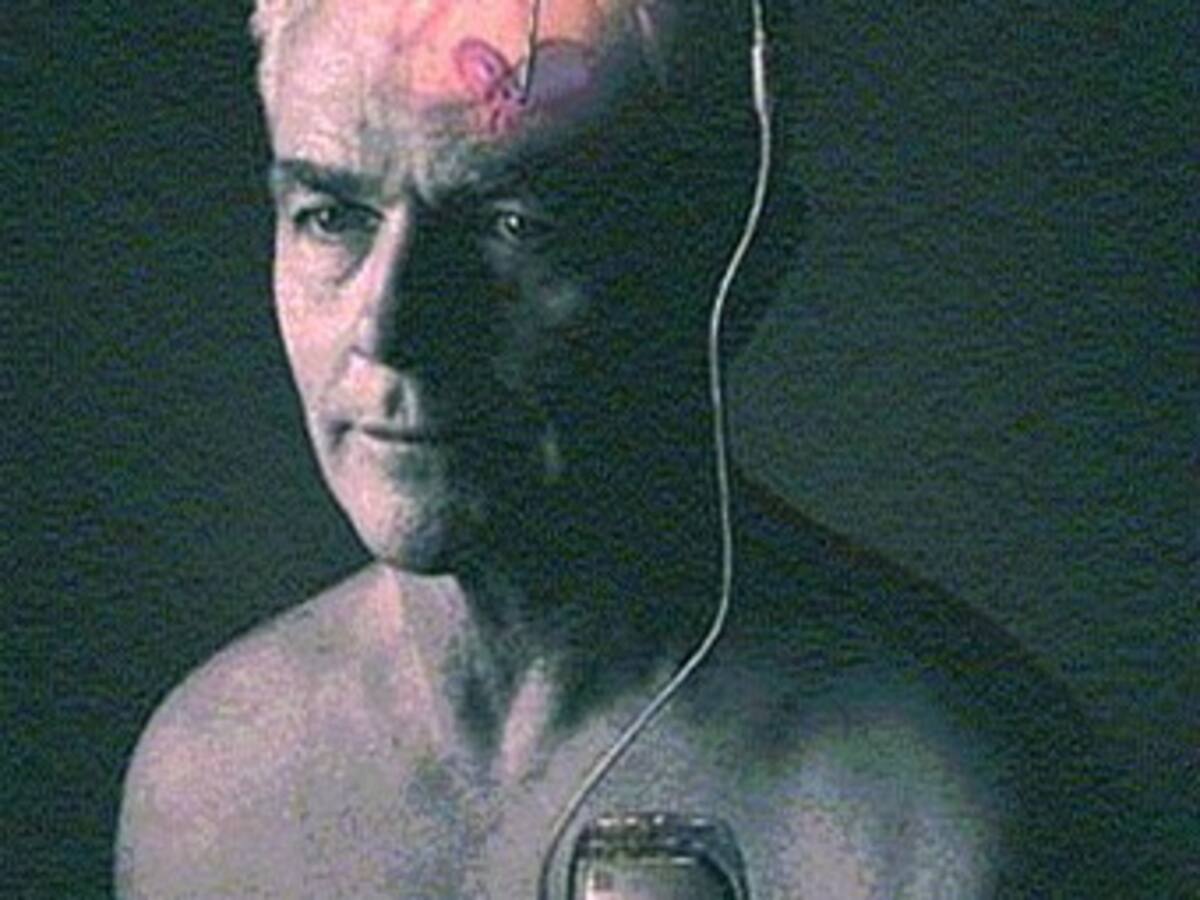 Más del 40 por ciento de los enfermos de parkinson sufre depresión