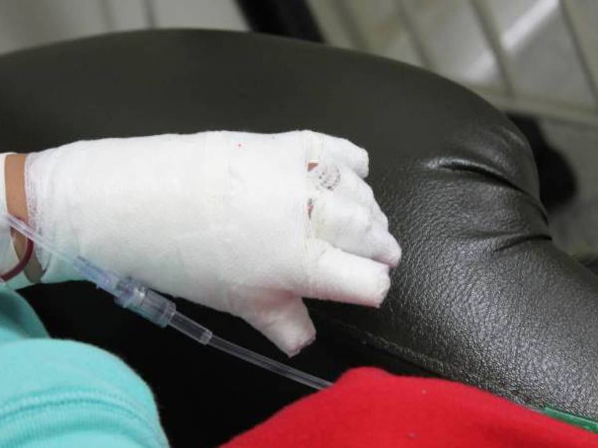 Padres de familia de un menor de edad quemado con pólvora deberán asistir a los cursos pedagógicos en Quindío