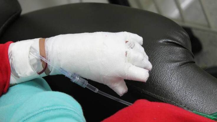 Padres de familia de un menor de edad quemado con pólvora deberán asistir a los cursos pedagógicos en Quindío