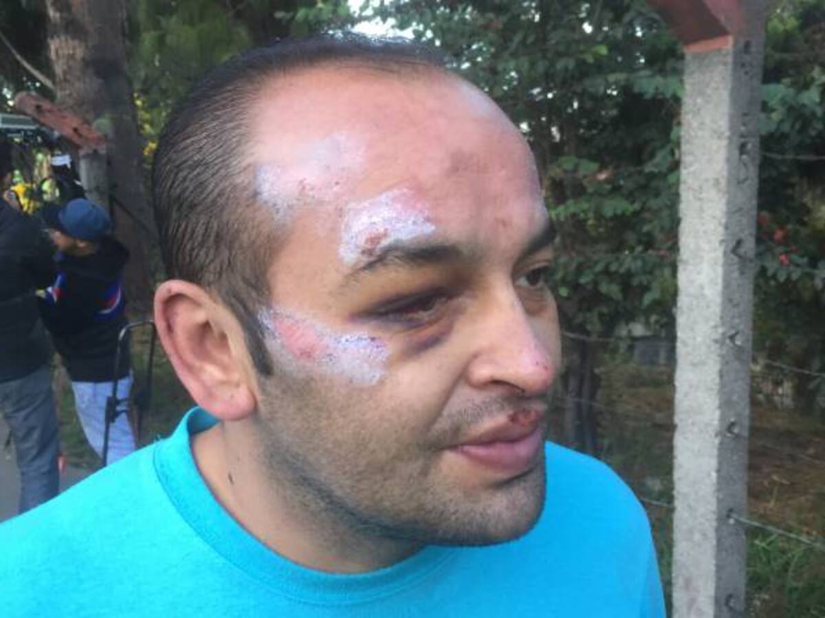 Golpean brutalmente a hombre que confunden con ladrón en Bogotá