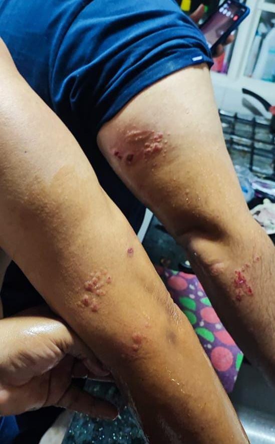 Volador cayó al lado de una familia