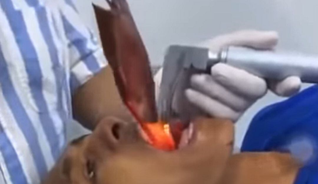 Médicos del municipio de Pivijay, Magdalena le extraen un pez a un hombre. 