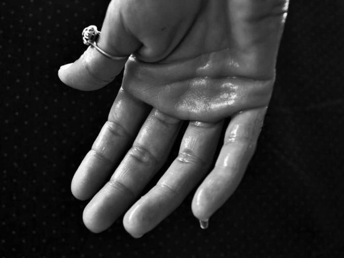 ¿Cómo combatir la sudoración excesiva?