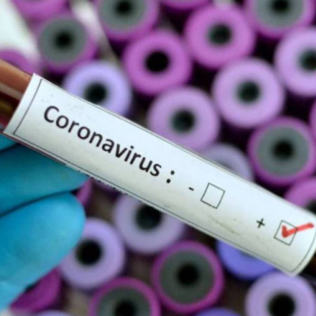 Reactivos para pruebas de Covid-19 llegarán a Pereira esta semana