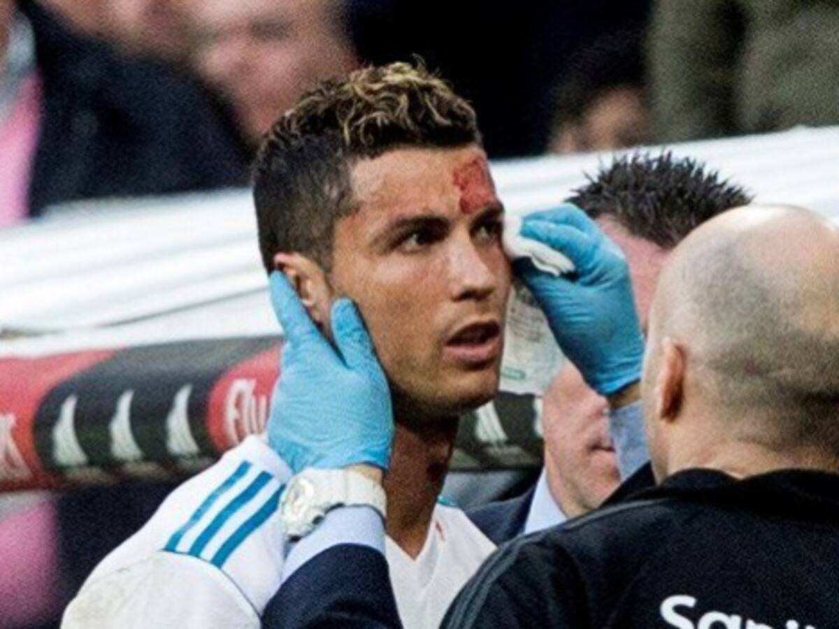 Así fue atendido Ronaldo tras sufrir un corte en la ceja izquierda