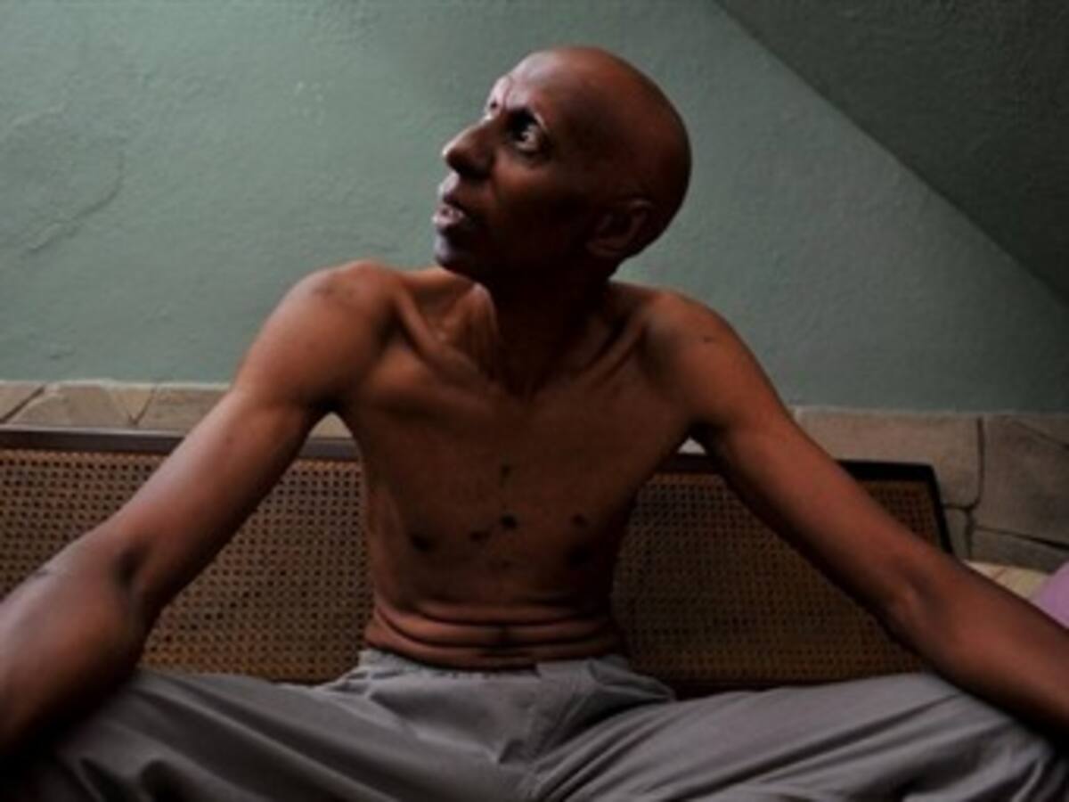 Disidente cubano Guillermo Fariñas está grave tras cirugía de vesícula