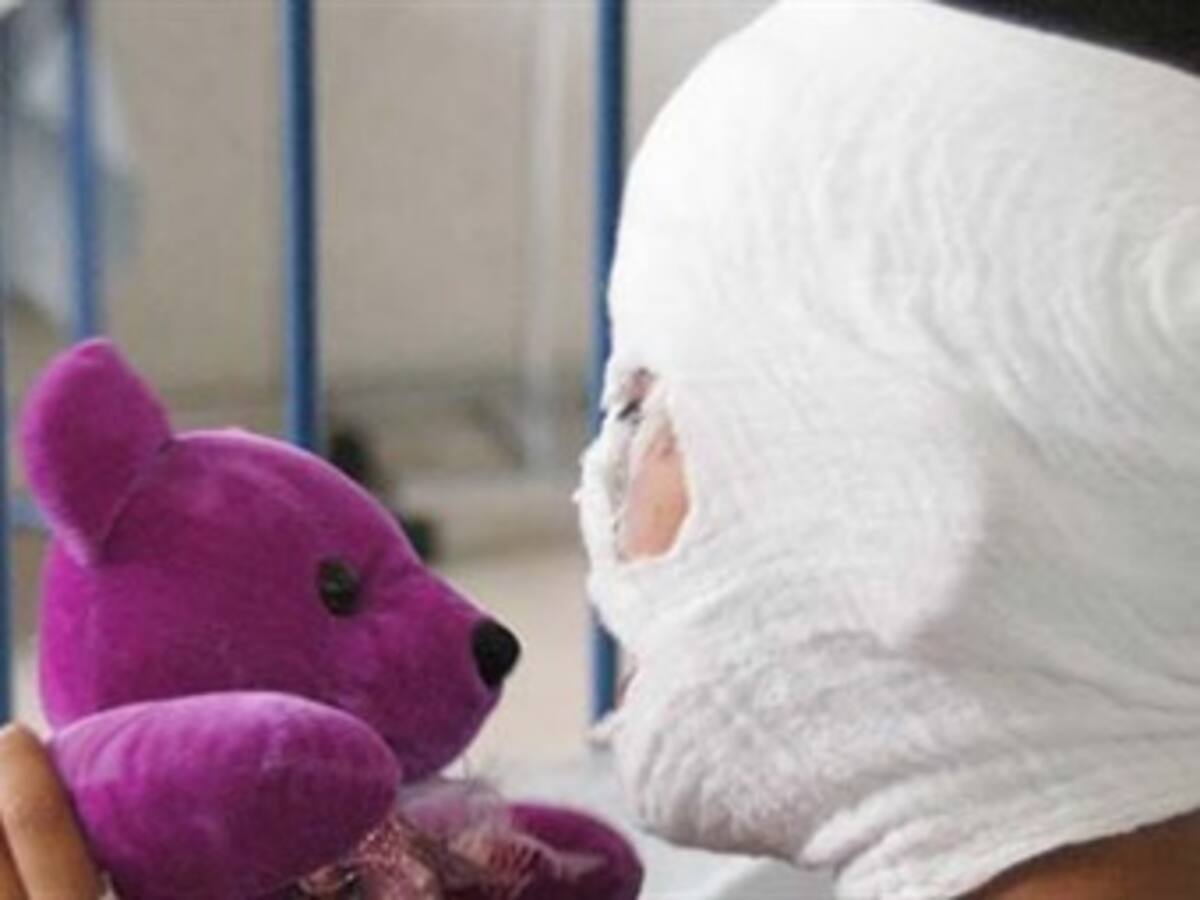 En Familia: Prevengamos el uso de pólvora en las fiestas decembrinas