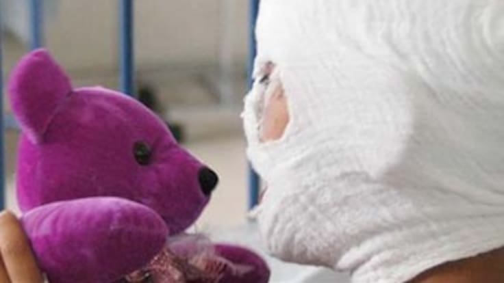 En Familia: Prevengamos el uso de pólvora en las fiestas decembrinas