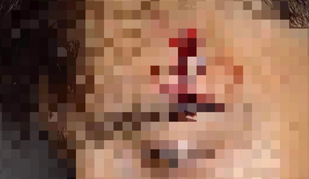 Foto: Suministrada por los familiares del agredido.