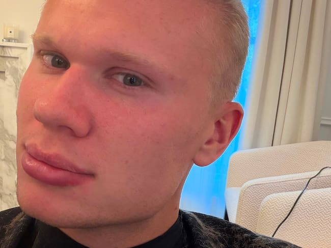 Erling Haalanda y su nuevo look / X: @Erling.