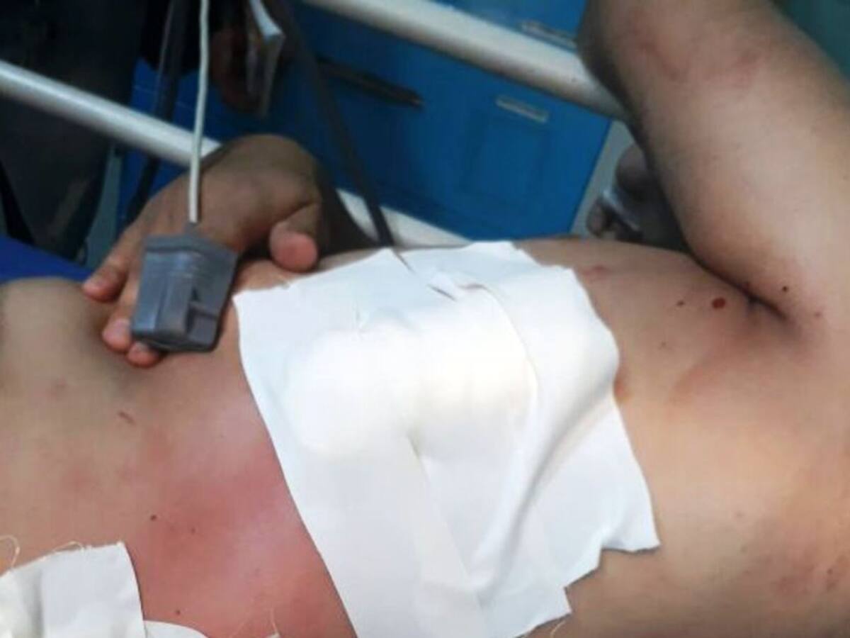 Falleció hombre herido con arma de fuego en un barrio de Arjona