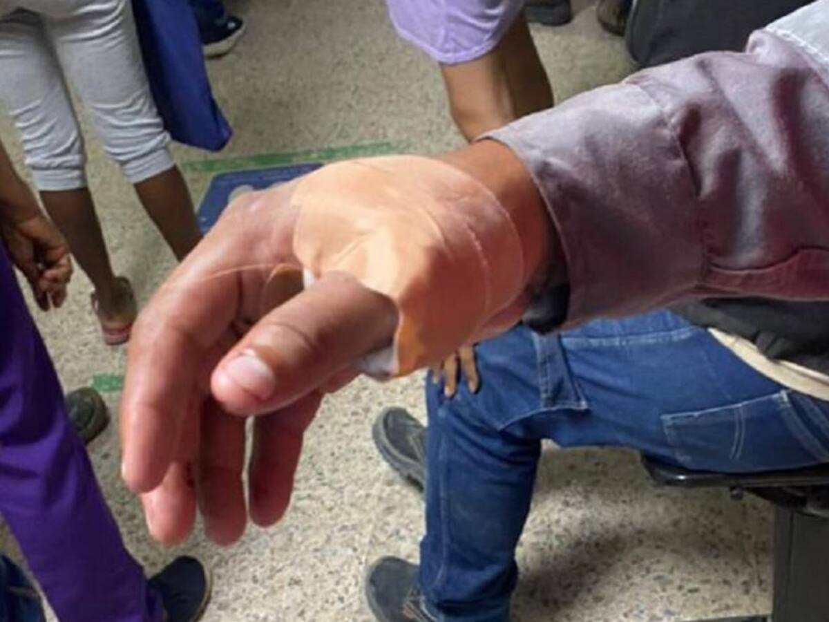 Hirieron a puñal a operario de Veolia durante un atraco en Bazurto