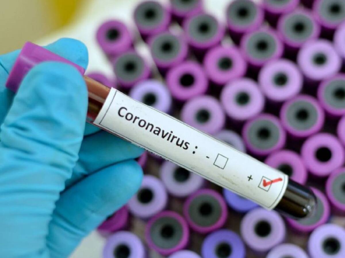 Autoridades sanitarias mantienen acciones preventivas por Coronavirus