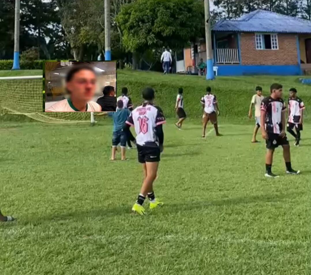 Uno de los futbolistas presenta fractura de tabique nasal  Foto: Cortesía Quindío 24 horas/ redes sociales