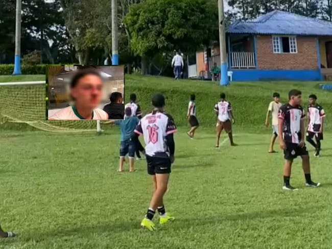 Uno de los futbolistas presenta fractura de tabique nasal Foto: Cortesía Quindío 24 horas/ redes sociales