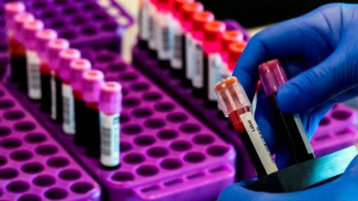 En un 53% aumentó el número de contagios de COVID-19 en Risaralda