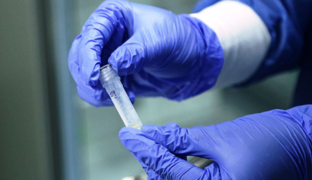 Crecen los contagios de VIH Sida