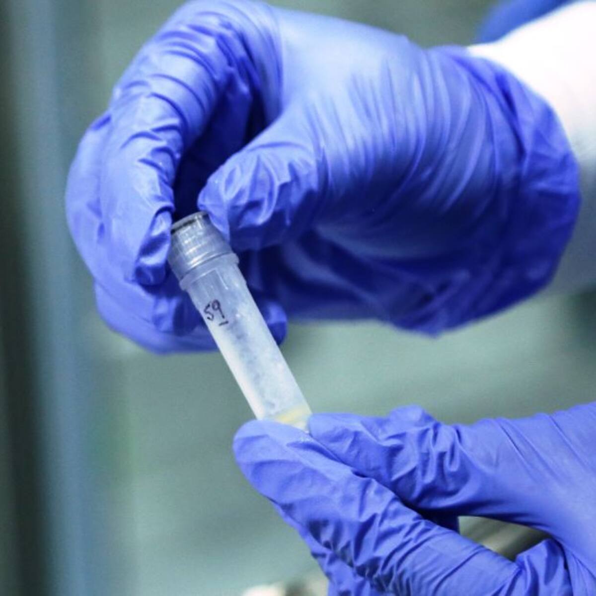 Autoridades de salud de Ibagué alerta sobre el aumento de casos de VIH/SIDA