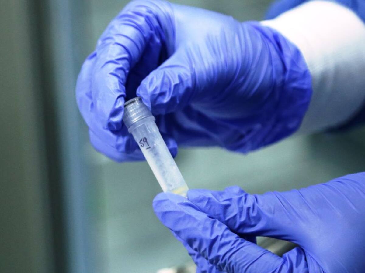 Ellos confirman que VIH y muerte no son sinónimos