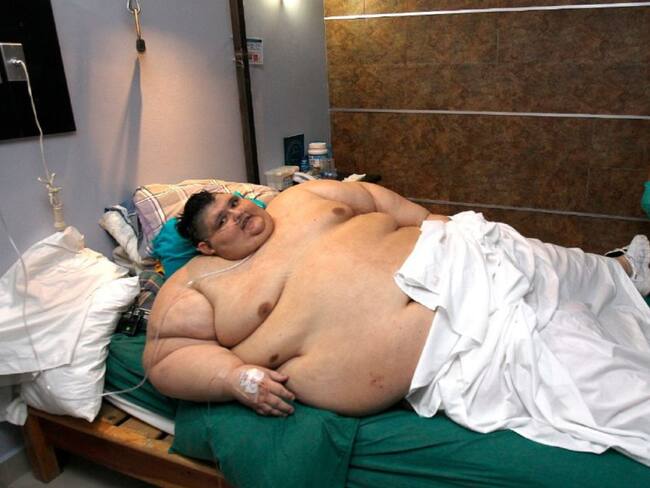 Del Guinness al hombre más gordo del mundo a superar la COVID en solo 3 años