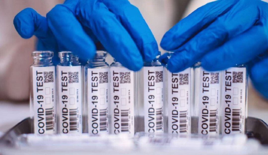 Es la primera vez desde el tercer pico, que el departamento no ocupa los primeros lugares de mayor contagio en el pais