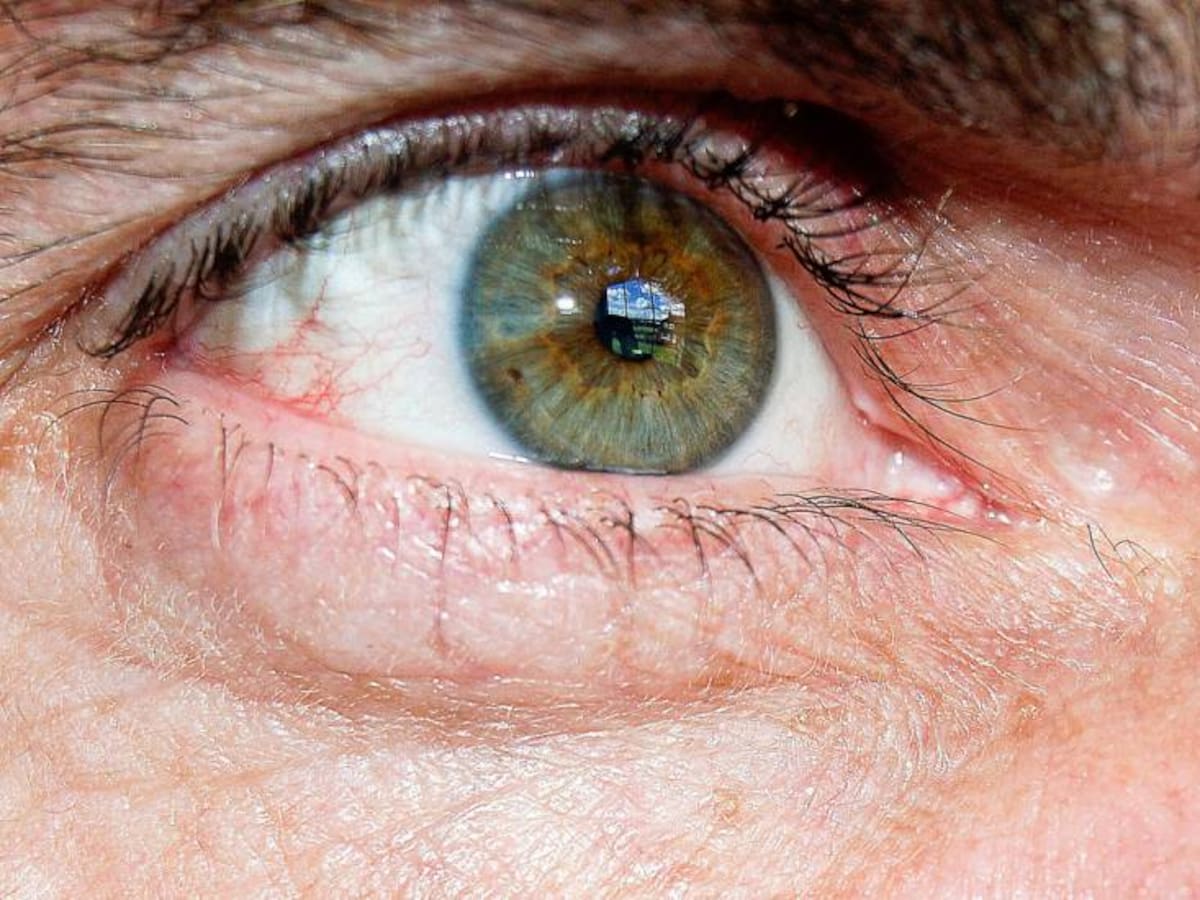 Échale un “ojo” a la diabetes