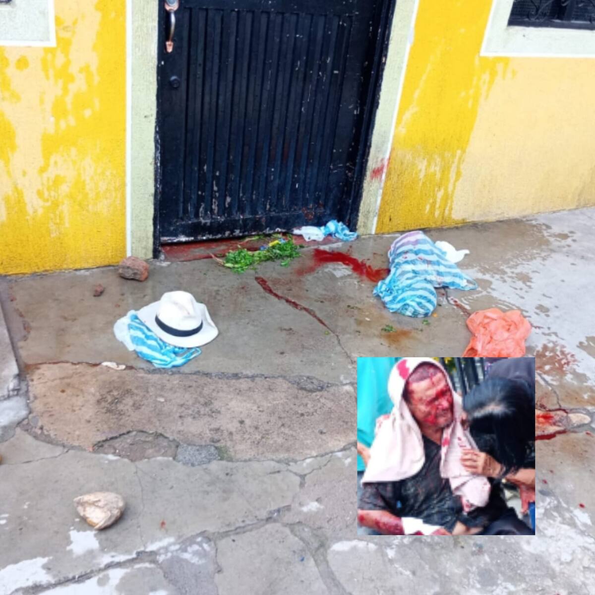 Adulto mayor fue brutalmente atacado por dos perros pitbull en Neiva