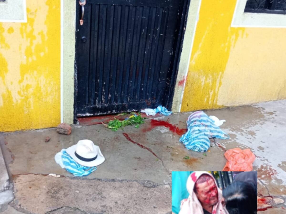 Adulto mayor fue brutalmente atacado por dos perros pitbull en Neiva