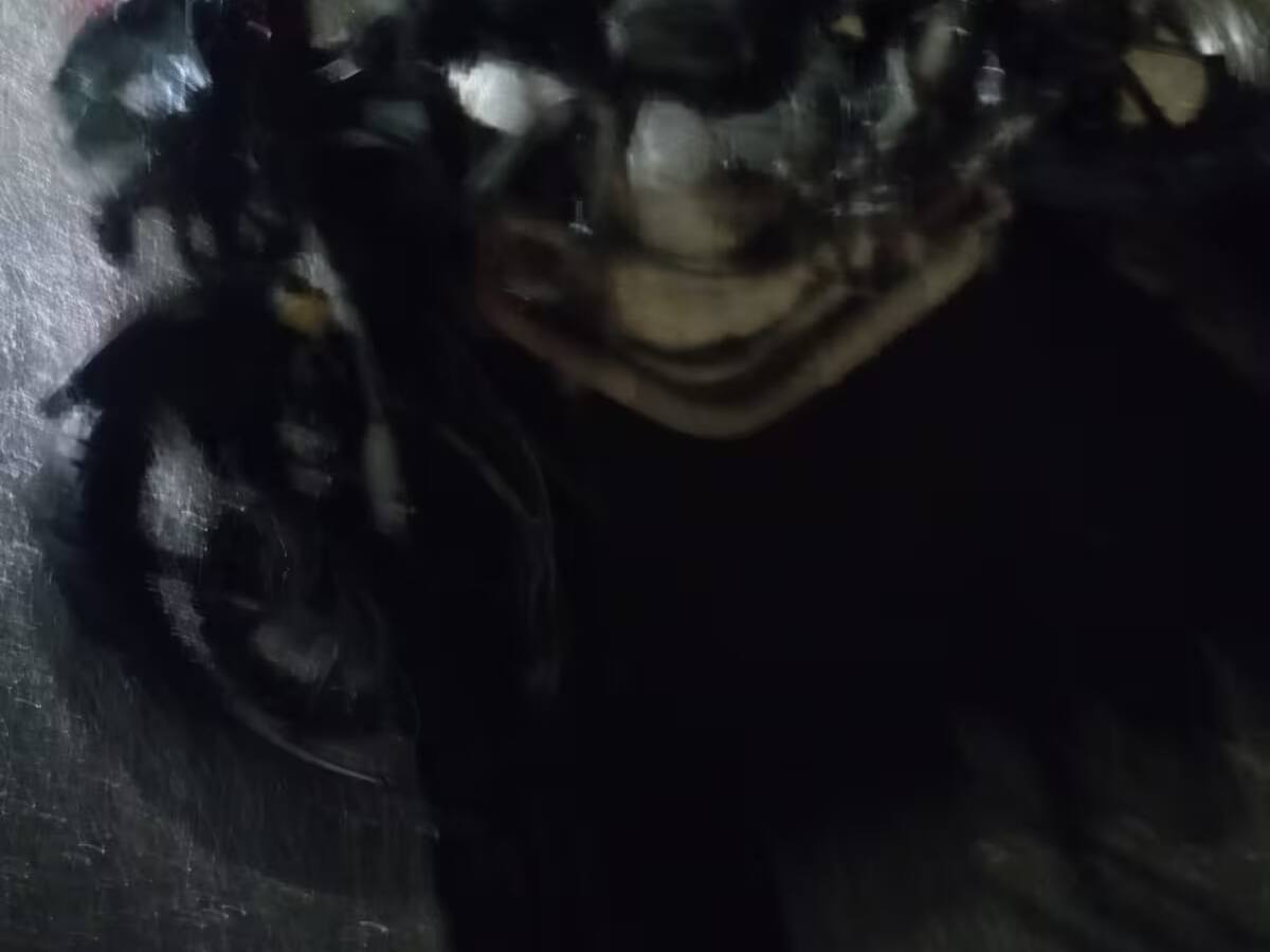 Falleció hombre tras ser arrollado por una motocicleta en Turbaco