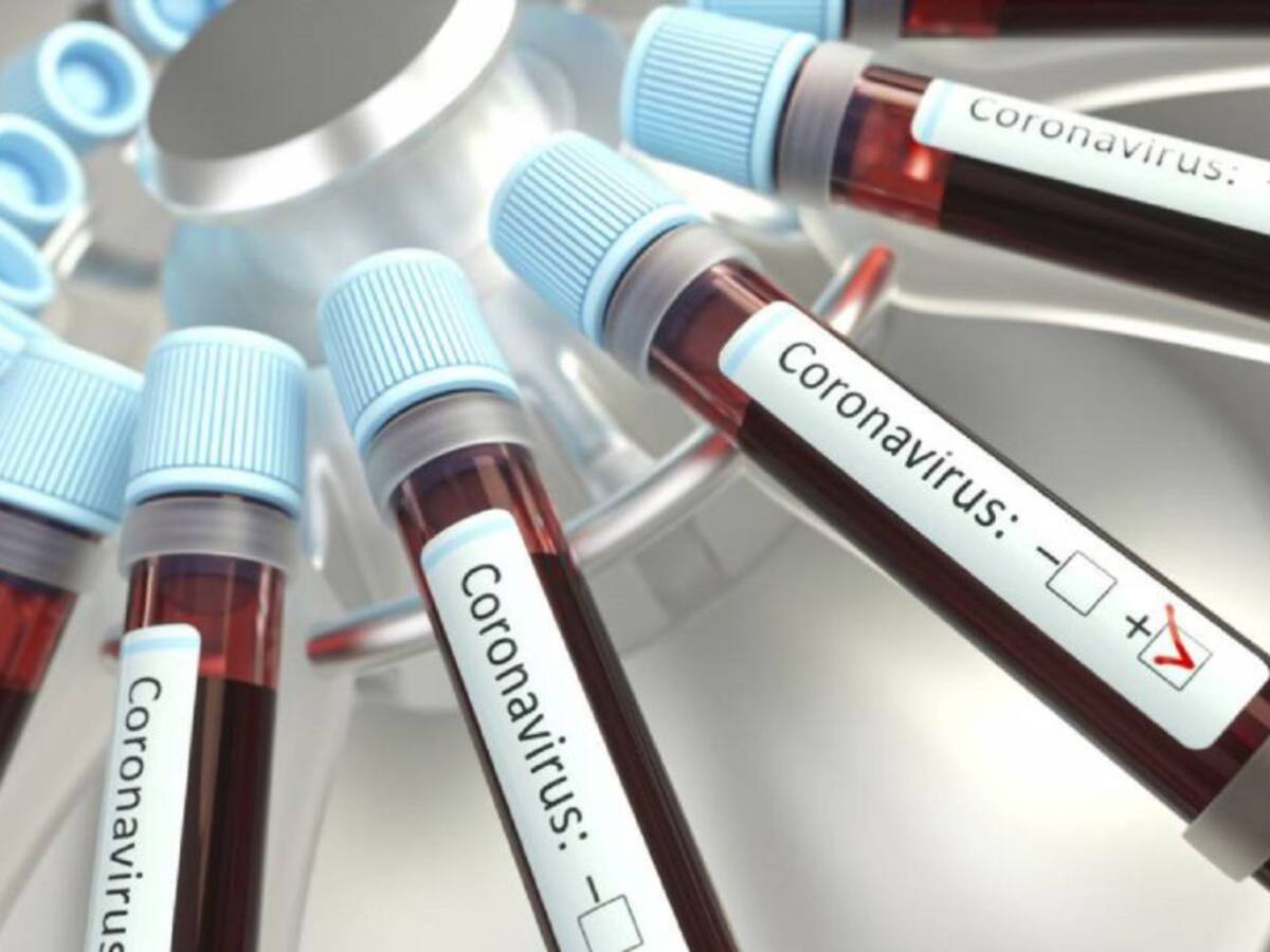 Coronavirus en Cartagena: 471 nuevos casos y tres fallecidos