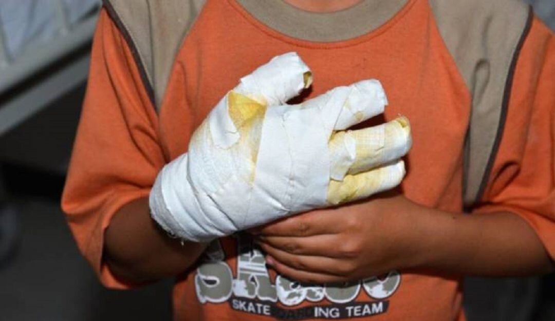 Entre los heridos por pólvora figuran dos menores de 7 y 17 años.