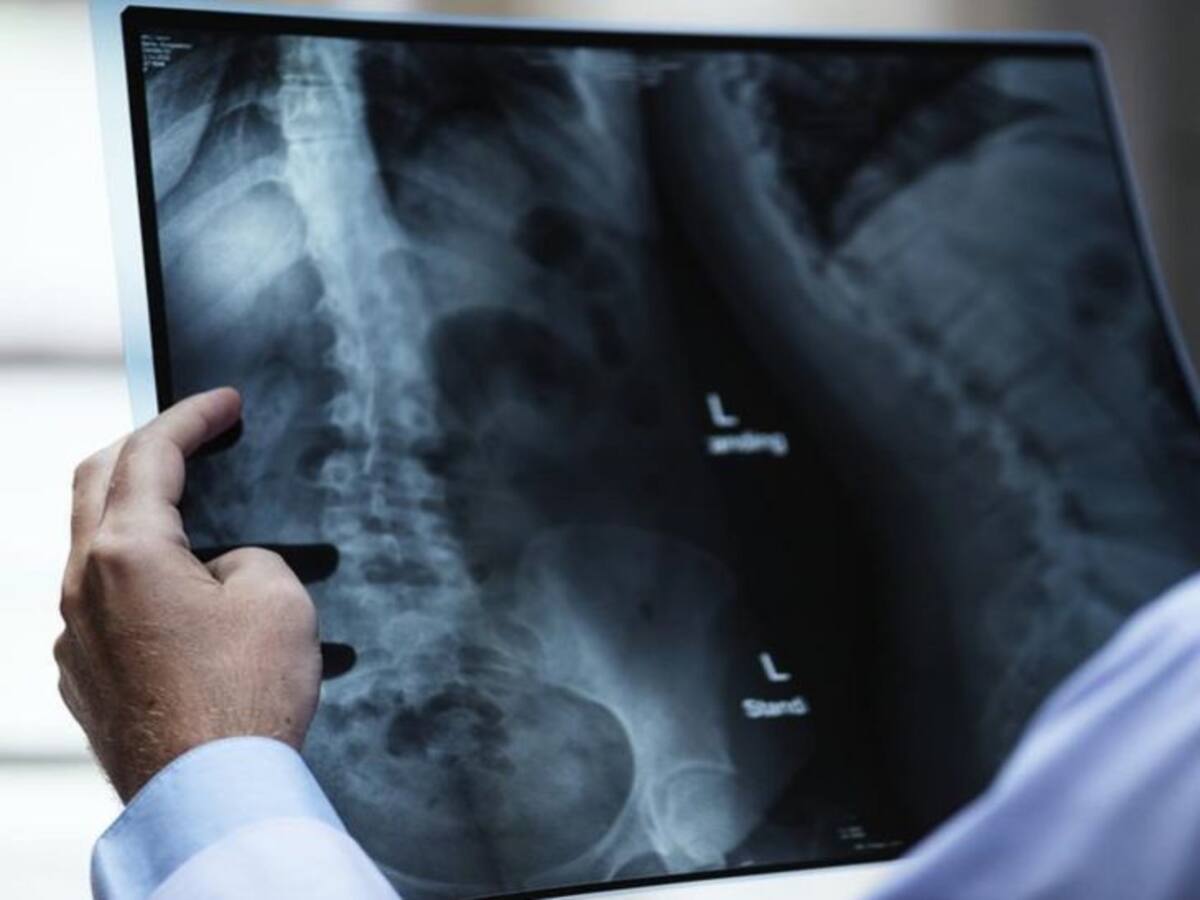 Renuncian médicos radiólogos del Hospital Universitario del Valle