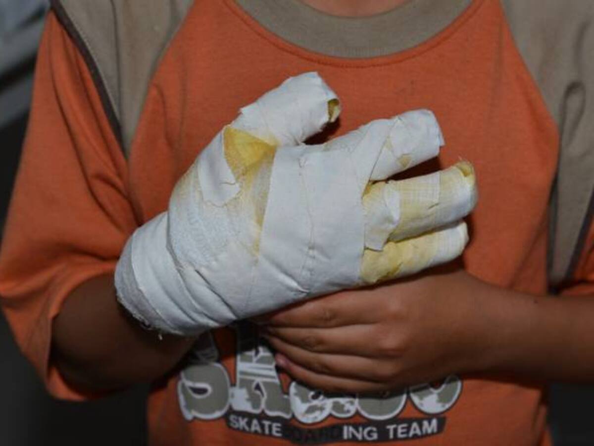 ICBF inicia 103 procesos a padres de niños lesionados con pólvora