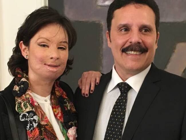 Natalia Ponce revela su rostro dos años después del ataque