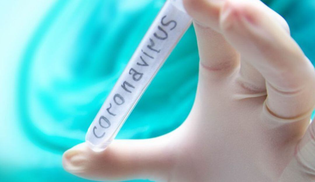 Imagen de referencia