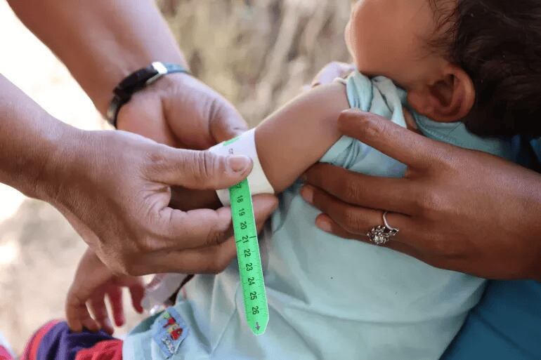 Esta problemática está estrechamente relacionada con la malnutrición en los niños. Foto Redes Sociales.