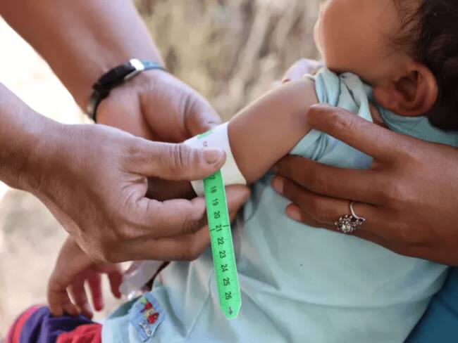 Esta problemática está estrechamente relacionada con la malnutrición en los niños. Foto Redes Sociales.