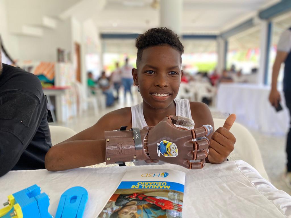 Se entregaron 36 prótesis impresas en tercera dimensión a 22 beneficiarios/ Foto: Cortesía