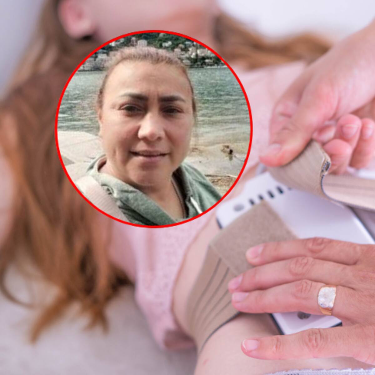 ¿Qué es la lipólisis láser? El procedimiento que se realizó Yulixa Toloza antes de desaparecer