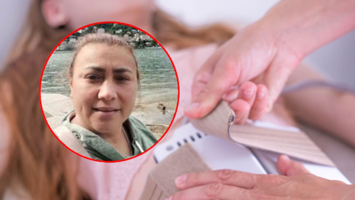 ¿Qué es la lipólisis láser? El procedimiento que se realizó Yulixa Toloza antes de desaparecer