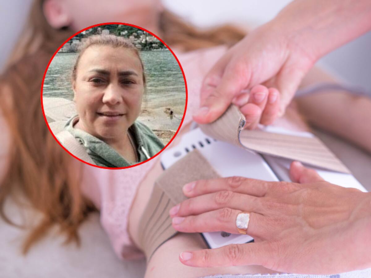 ¿Qué es la lipólisis láser? El procedimiento que se realizó Yulixa Toloza antes de desaparecer