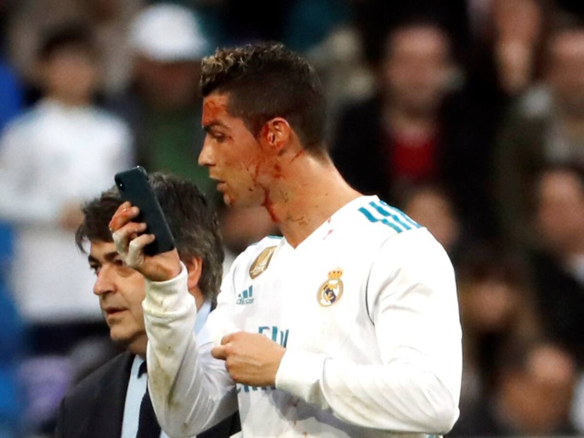 Cristiano se retiró con un corte cerca del ojo izquierdo
