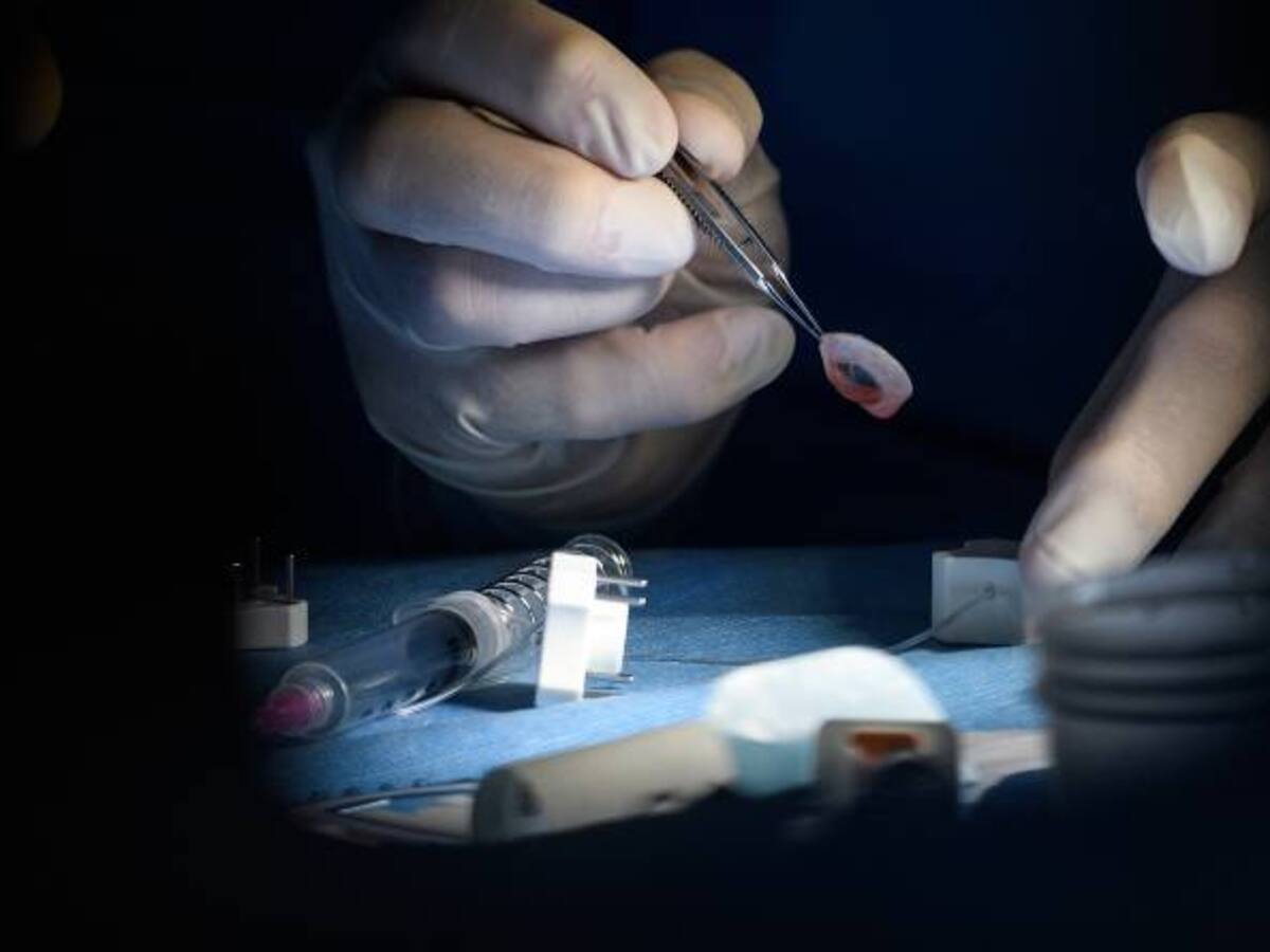 Estrategia del INS para aumentar trasplantes cornea